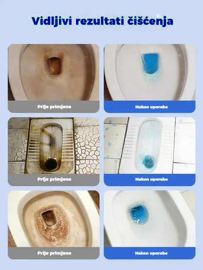💦💧【Set od tri kutije】Snažne šumeće tablete za čišćenje toaleta