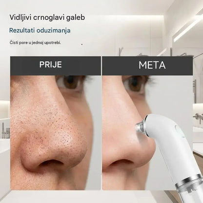 Električna četka za čišćenje lica - zateže i podiže - dubinski čisti pore